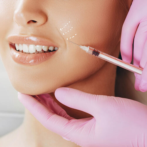 Filler Acido Ialuronico e Botox