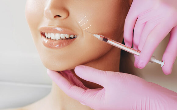 Filler Acido Ialuronico e Botox